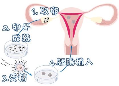胚胎培養